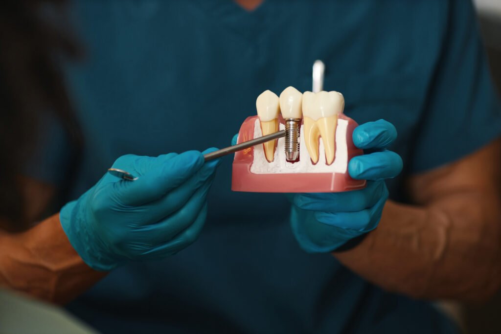 All-on-4 implant ile sabit diş tedavisi — Dt. Onur Hökümdar